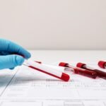 Exame de sangue detecta retorno do câncer antes da tomografia
