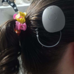 Paraná amplia acesso à audiçãoe lidera implantes cocleares no país