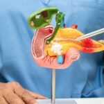 Sensor brasileiro pode antecipar diagnóstico de câncer no pâncreas