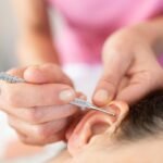 Estudo indica que auriculoterapia pode aliviar sintomas da enxaqueca